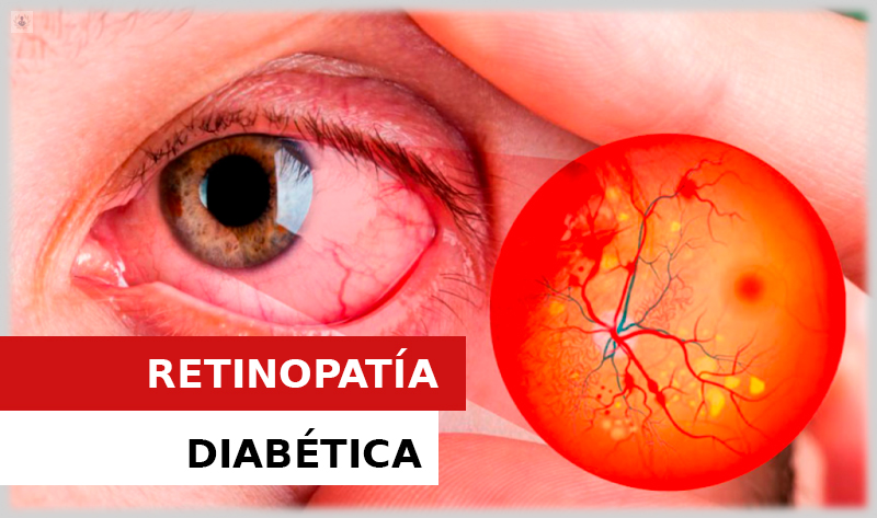Imagen del artículo
